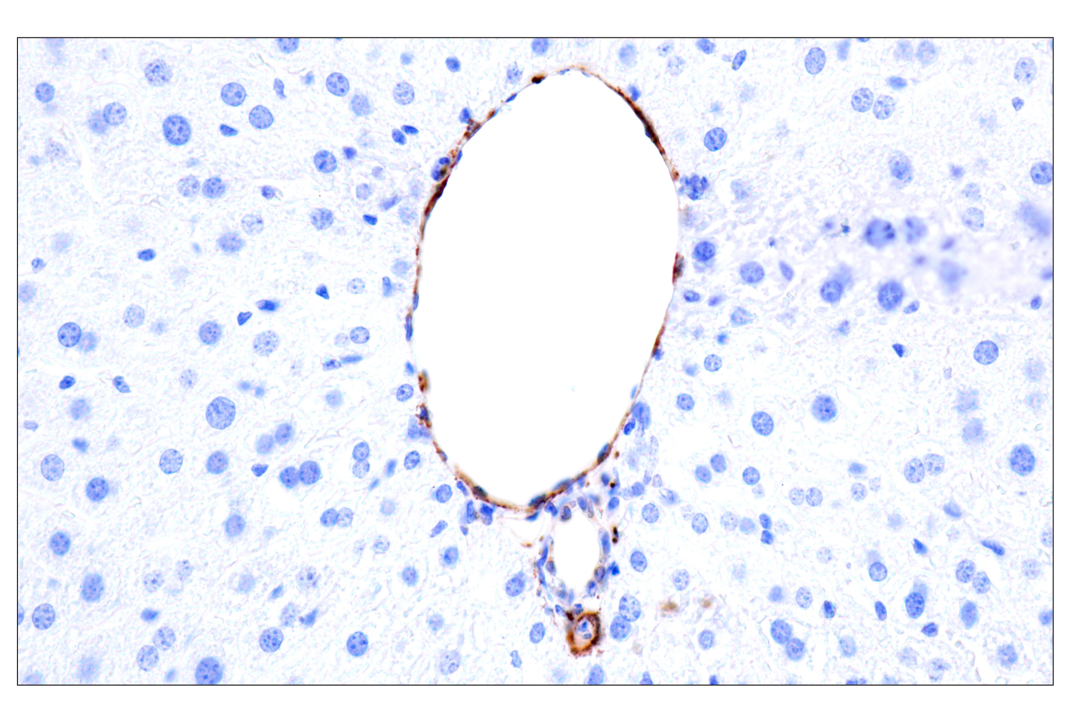 Immunohistochemistry Image 21: MAP1B (E8S8R) Rabbit mAb (BSA and Azide Free)