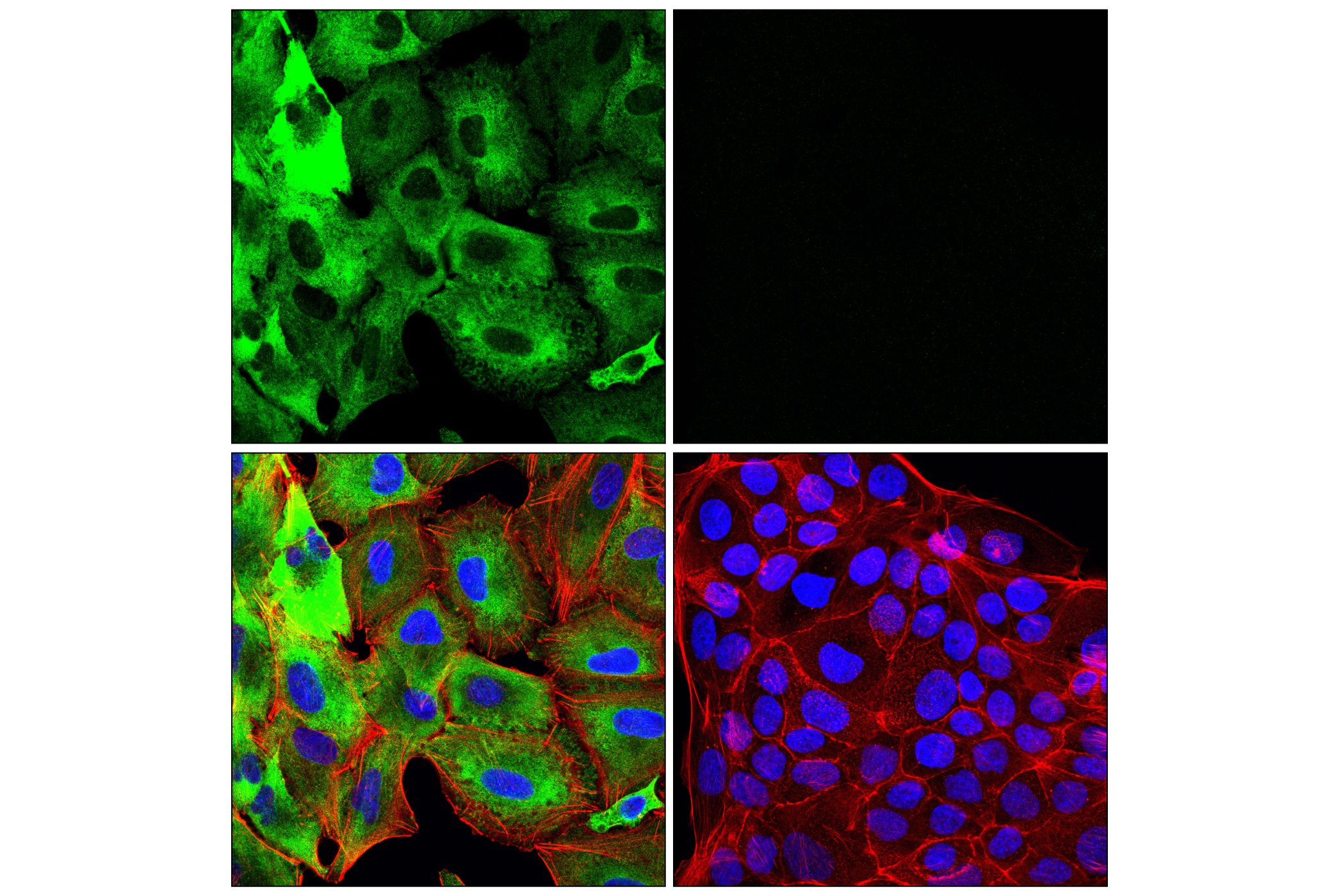 Immunofluorescence Image 3: MAP1B (E8S8R) Rabbit mAb (BSA and Azide Free)