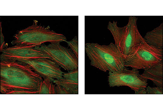 Immunofluorescence Image 1: HSP70 (6B3) Rat mAb