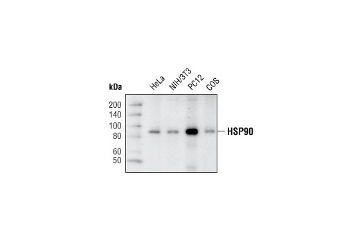  Image 10: HSP/Chaperone Antibody Sampler Kit
