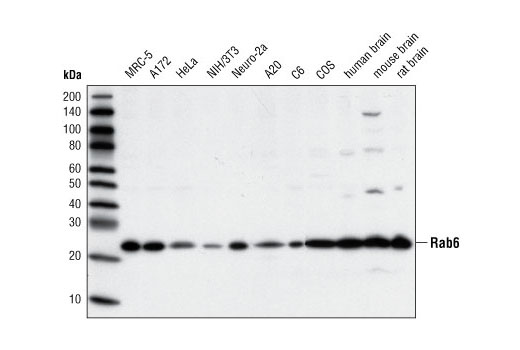 Western Blotting Image 1: Rab6 Antibody