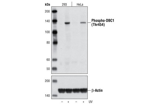 Western Blotting Image 1: Phospho-DBC1 (Thr454) Antibody