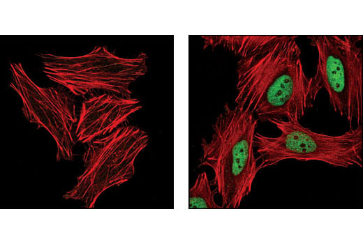 Immunofluorescence Image 1: Phospho-DBC1 (Thr454) Antibody