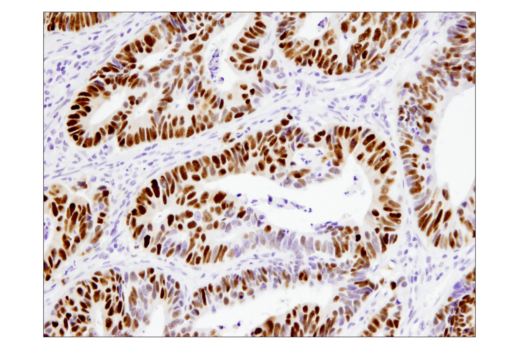 Immunohistochemistry Image 2: p53 (DO-7) Mouse mAb