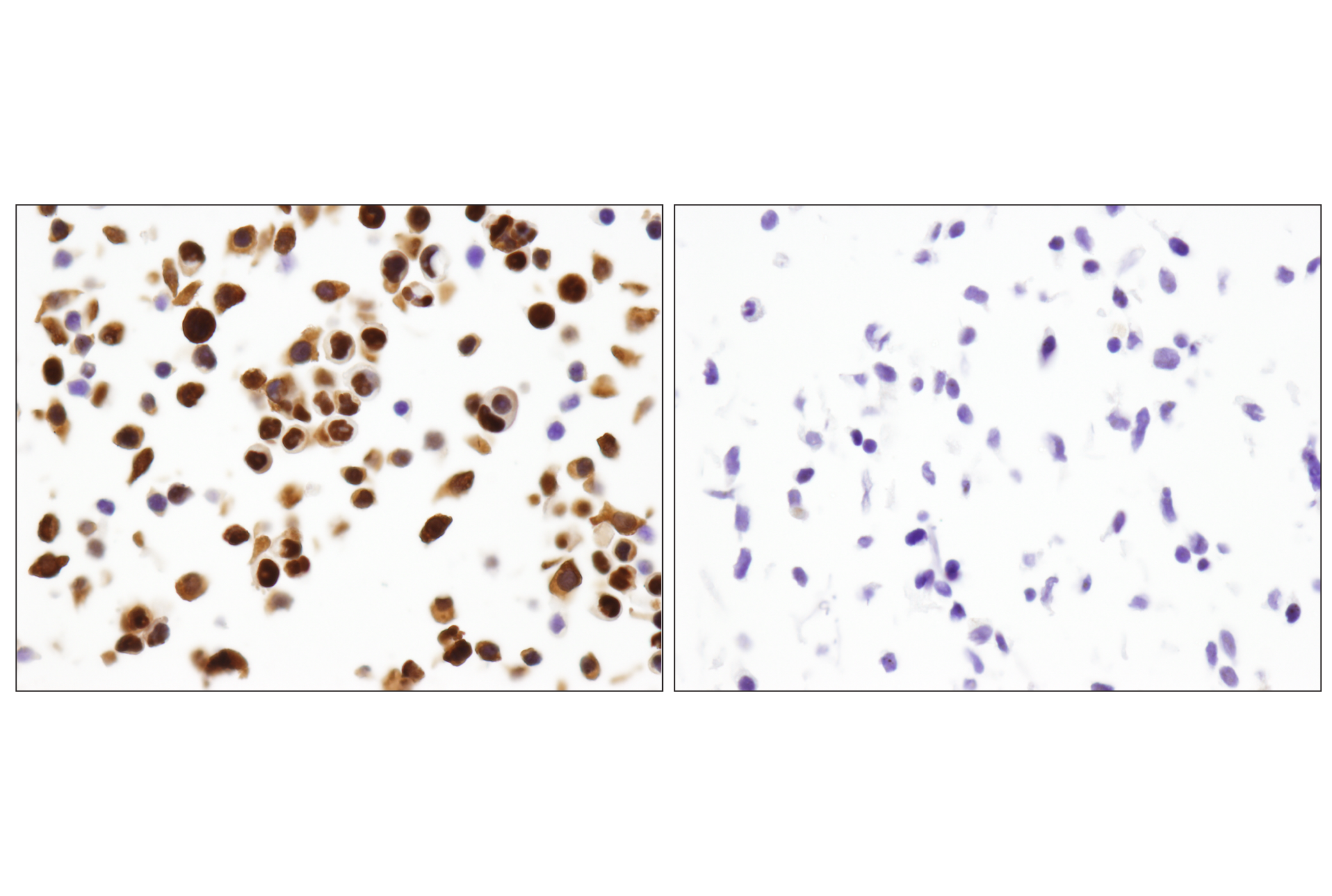 Immunohistochemistry Image 4: p53 (DO-7) Mouse mAb
