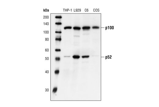  Image 6: NF-κB Non-Canonical Pathway Antibody Sampler Kit