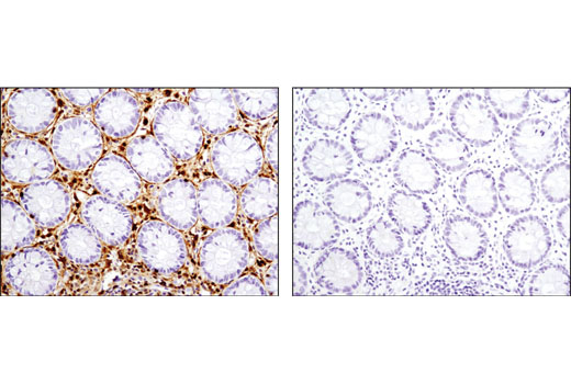 Immunohistochemistry Image 1: S100A4 (D9F9D) Rabbit mAb (BSA and Azide Free)