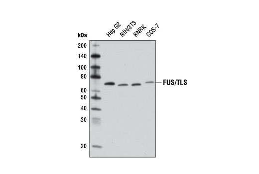 Western Blotting Image 1: FUS/TLS Antibody