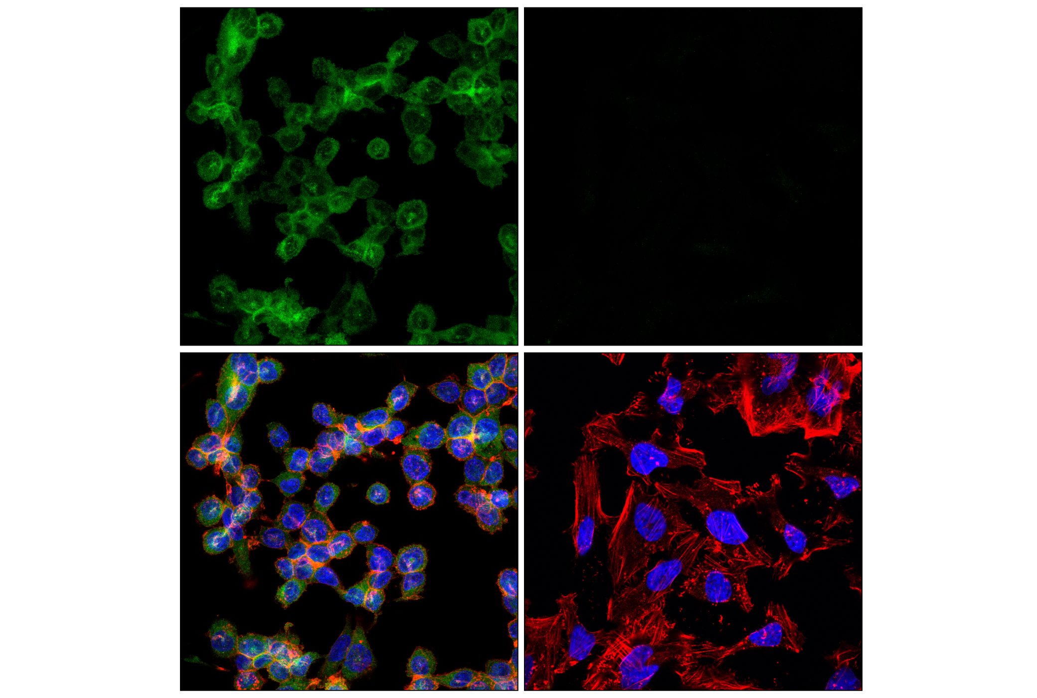 Immunofluorescence Image 1: IRF-5 (E7F9W) Rabbit mAb (Alexa Fluor® 488 Conjugate)