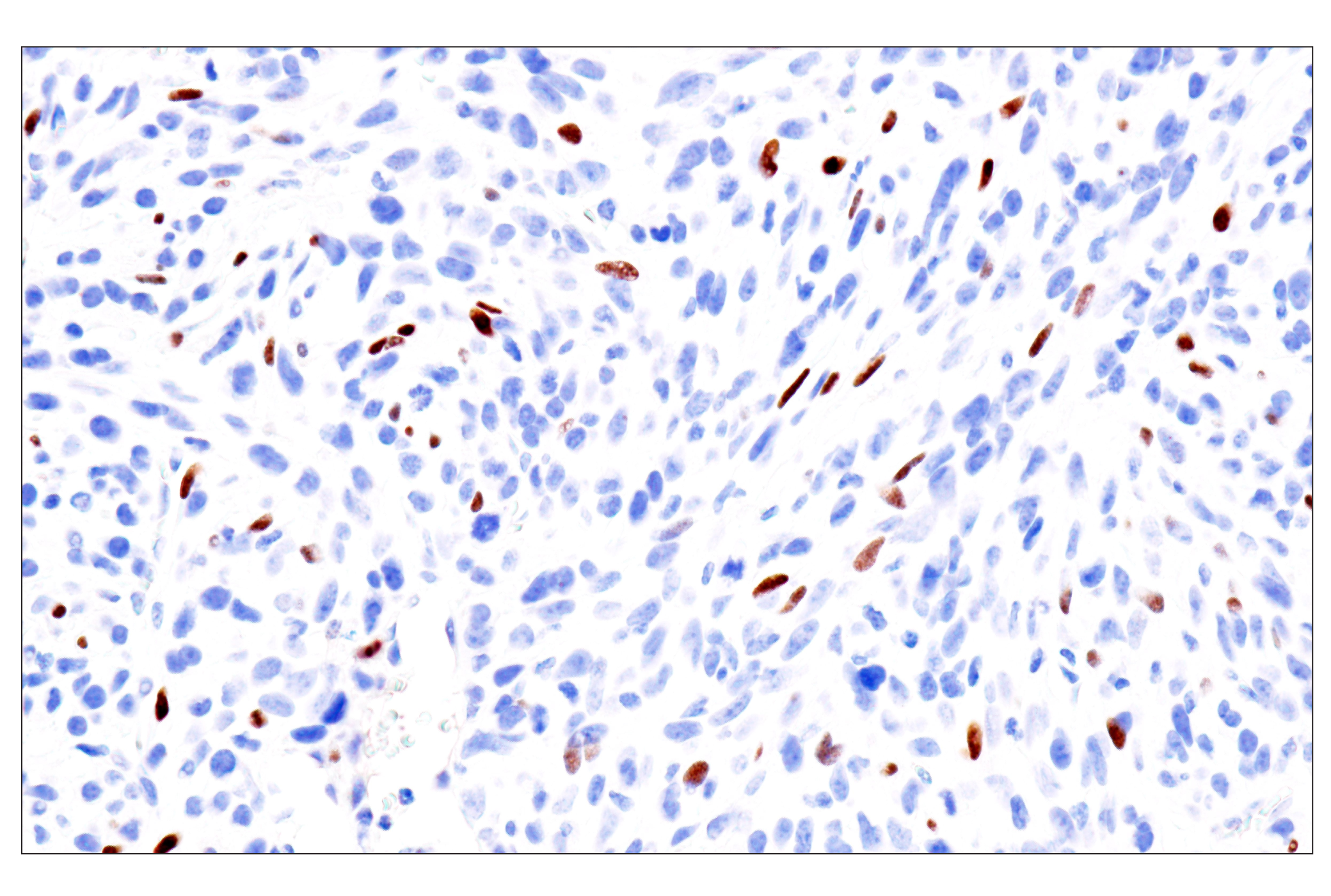 Immunohistochemistry Image 17: GATA-6 (D61E4) XP® Rabbit mAb (BSA and Azide Free)
