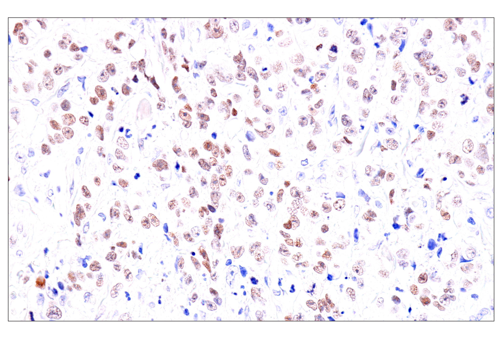 Immunohistochemistry Image 7: GATA-6 (D61E4) XP® Rabbit mAb (BSA and Azide Free)