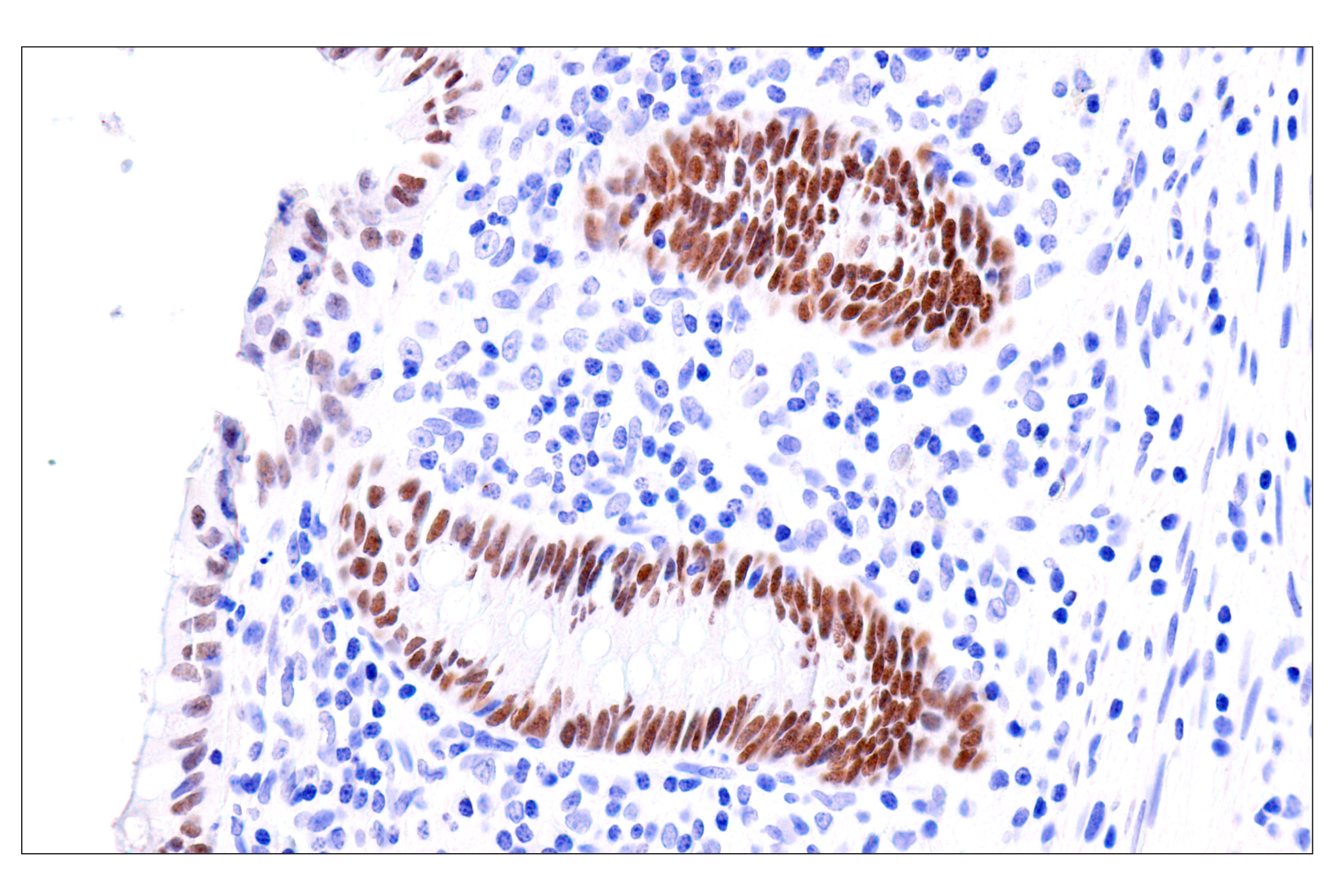 Immunohistochemistry Image 14: GATA-6 (D61E4) XP® Rabbit mAb (BSA and Azide Free)