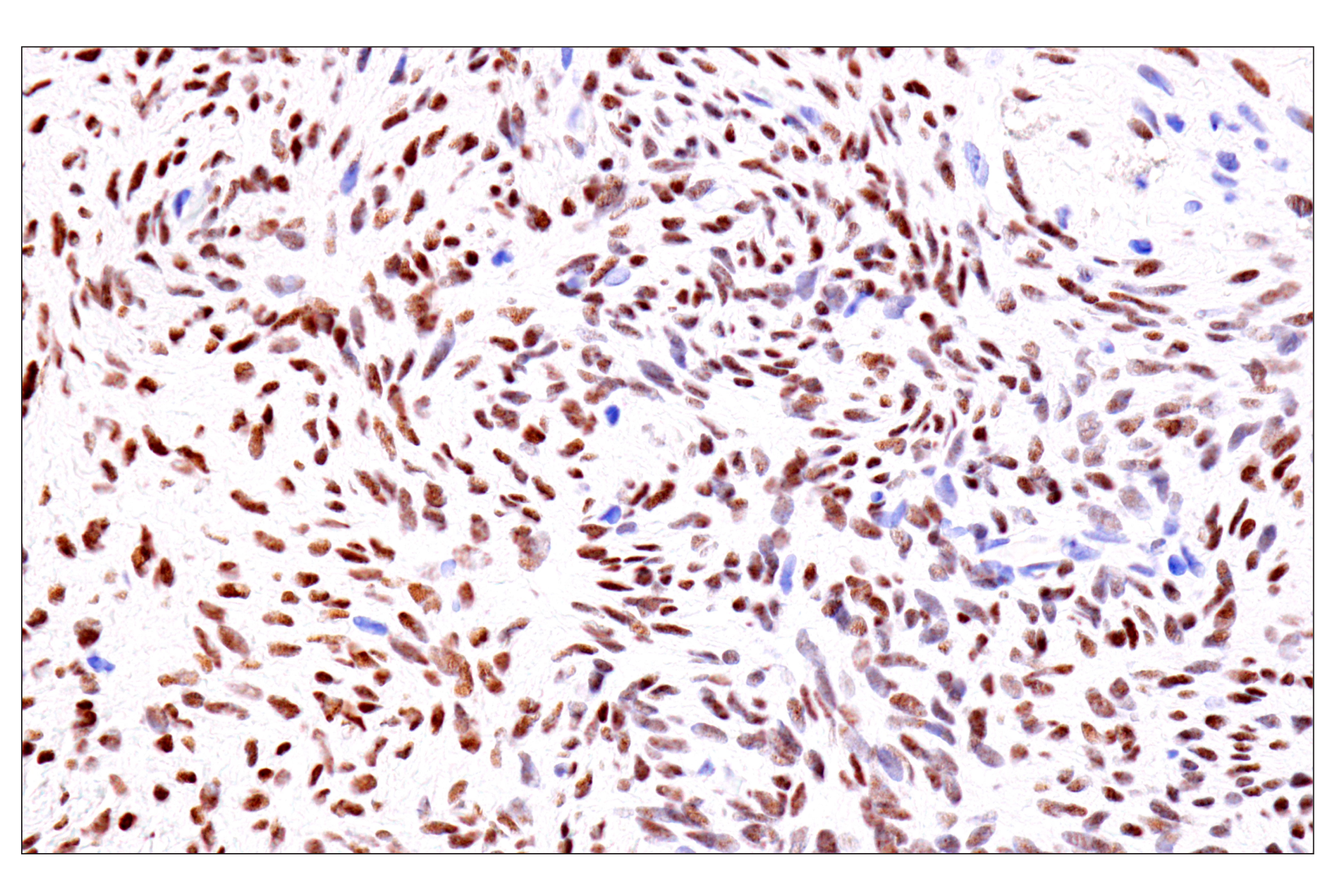 Immunohistochemistry Image 11: GATA-6 (D61E4) XP® Rabbit mAb (BSA and Azide Free)