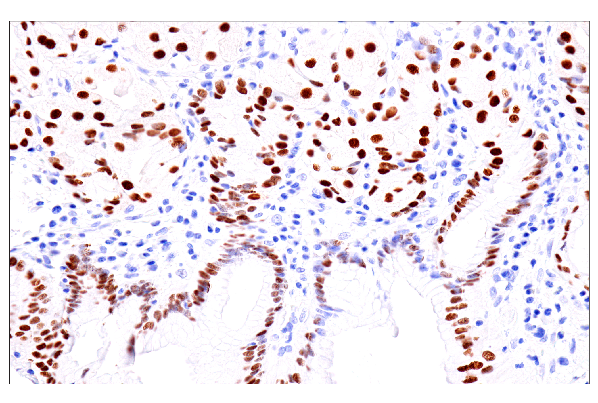 Immunohistochemistry Image 8: GATA-6 (D61E4) XP® Rabbit mAb (BSA and Azide Free)