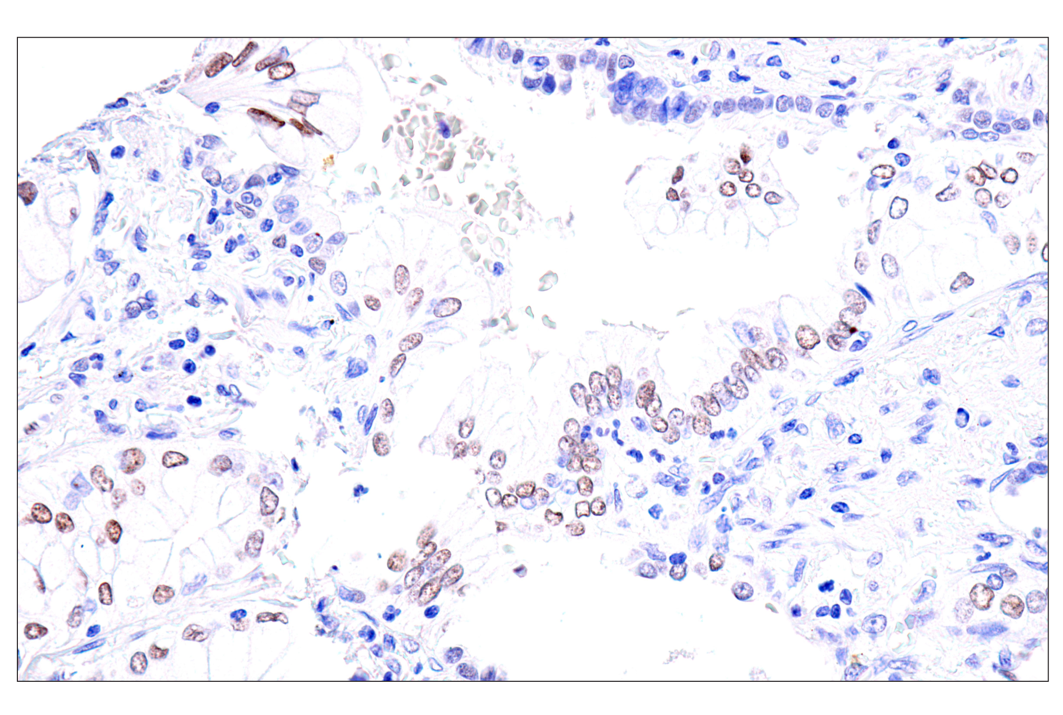 Immunohistochemistry Image 6: GATA-6 (D61E4) XP® Rabbit mAb (BSA and Azide Free)