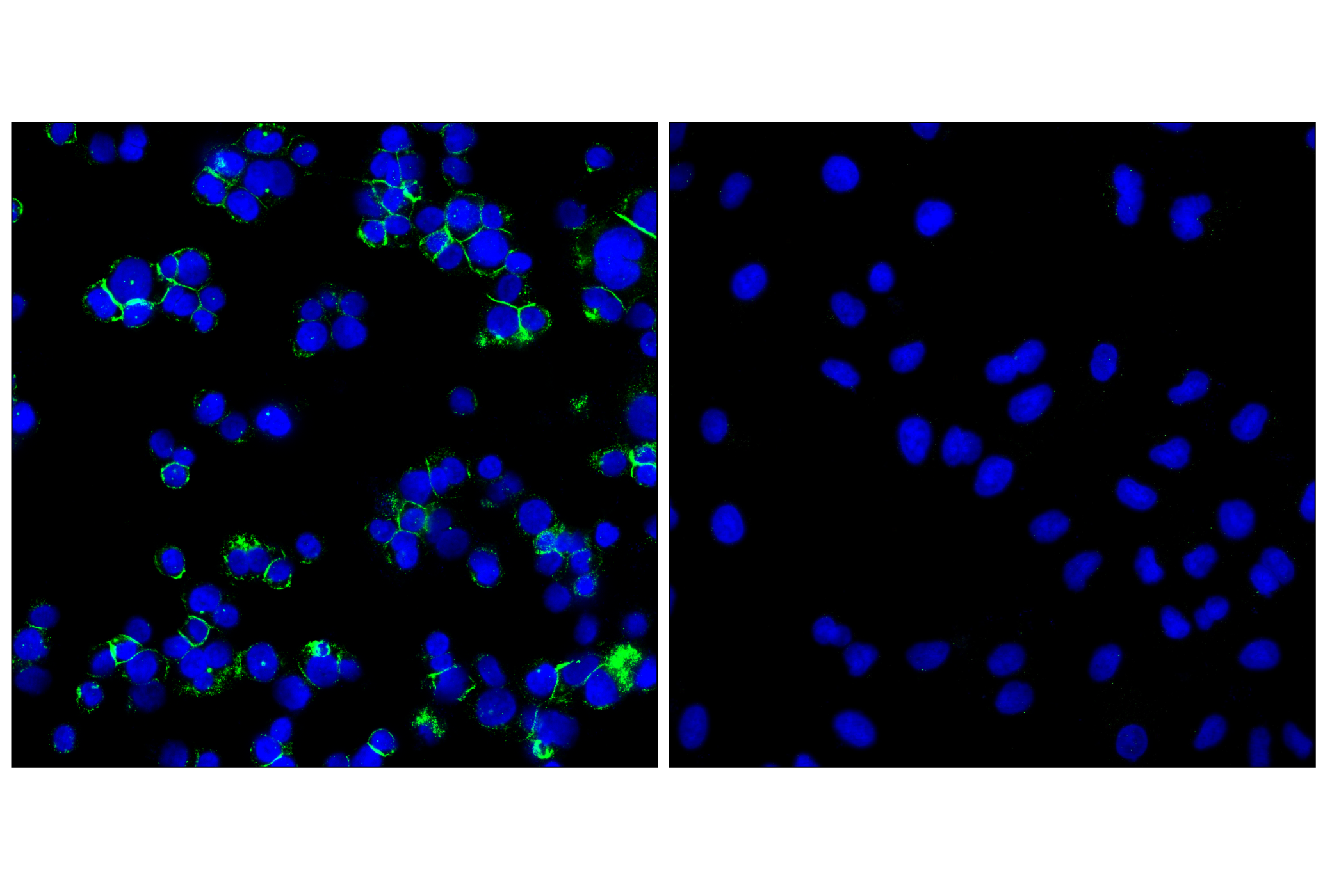 Immunofluorescence Image 1: CD11b/ITGAM (E3J2F) Rabbit mAb