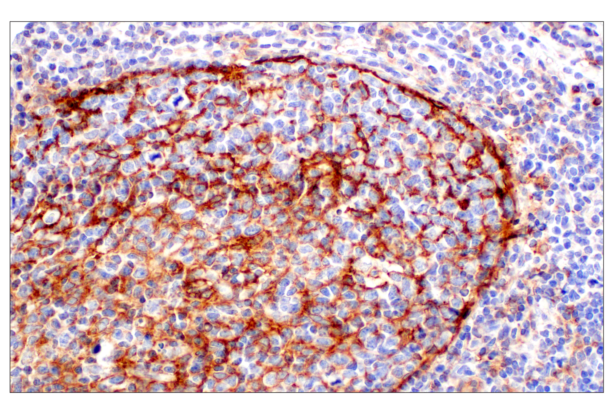 Immunohistochemistry Image 11: CD11b/ITGAM (E3J2F) Rabbit mAb
