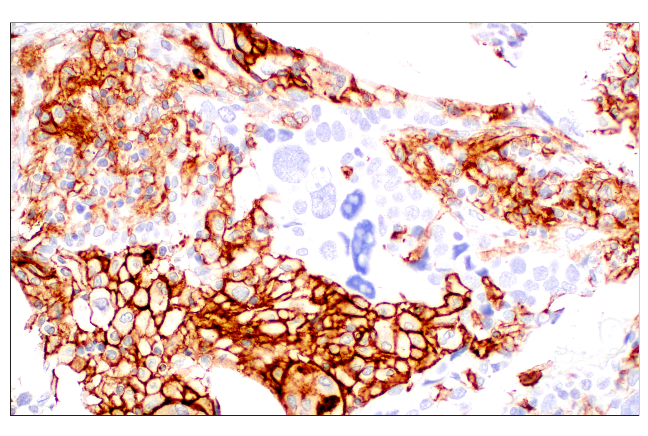 Immunohistochemistry Image 1: CD11b/ITGAM (E3J2F) Rabbit mAb