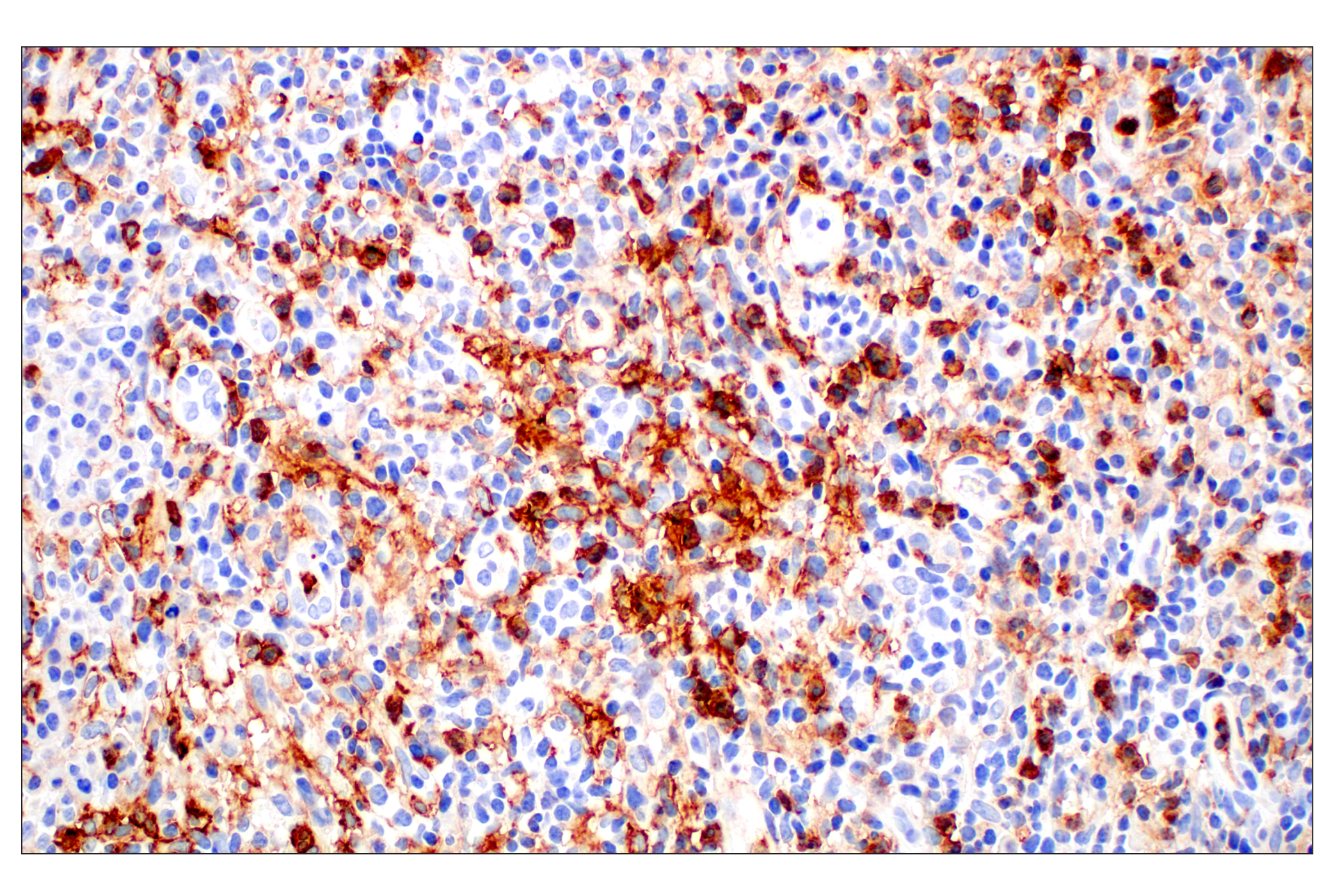 Immunohistochemistry Image 2: CD11b/ITGAM (E3J2F) Rabbit mAb