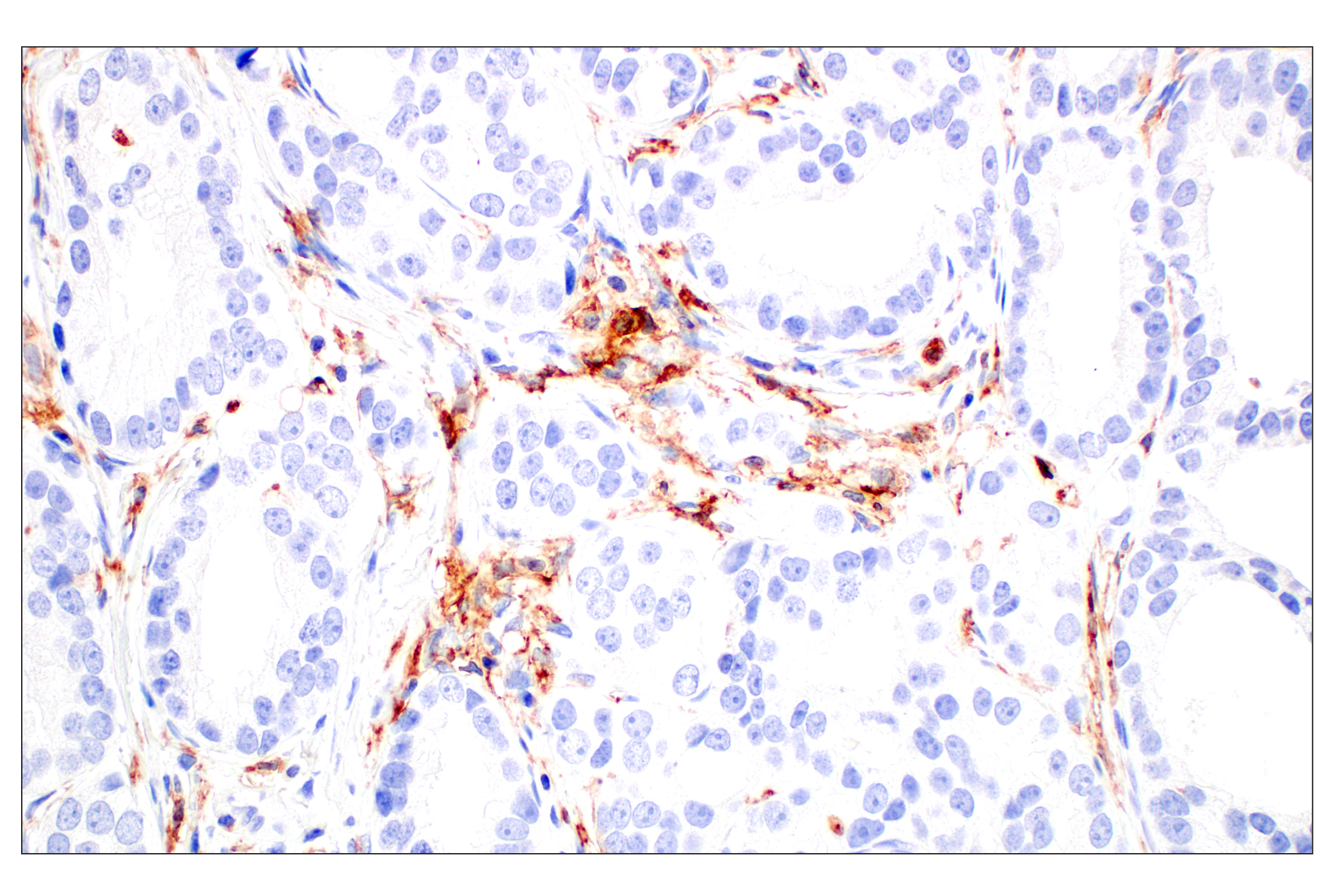 Immunohistochemistry Image 4: CD11b/ITGAM (E3J2F) Rabbit mAb
