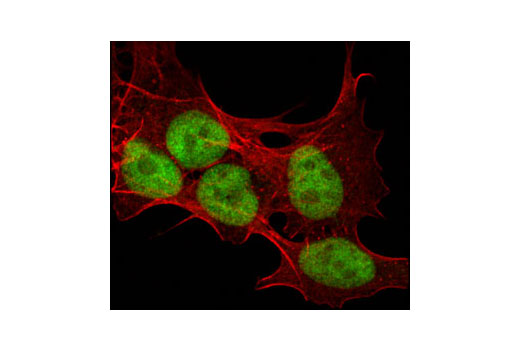 Immunofluorescence Image 1: UBE1a Antibody