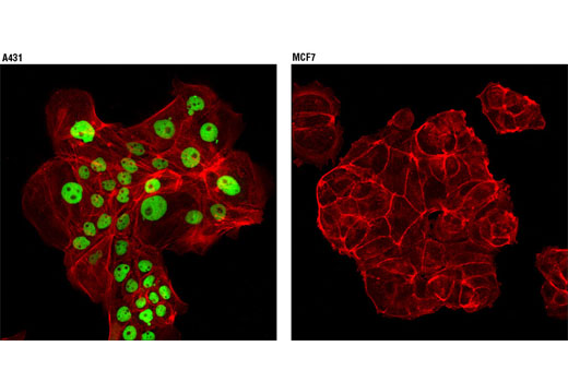 Immunofluorescence Image 1: p63-α Antibody