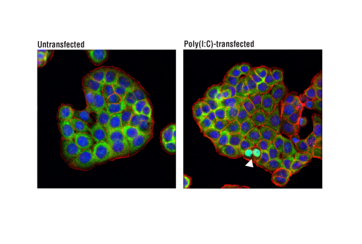 Immunofluorescence Image 1: IRF-3 (D9J5Q) Mouse mAb (BSA and Azide Free)