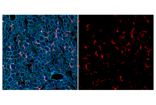 Immunofluorescence Image 2: Iba1/AIF-1 (E4O4W) XP® Rabbit mAb (Alexa Fluor® 594 Conjugate)