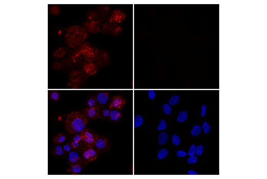 Immunofluorescence Image 3: Iba1/AIF-1 (E4O4W) XP® Rabbit mAb (Alexa Fluor® 594 Conjugate)