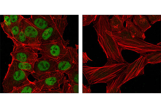 Immunofluorescence Image 1: Nanog (1E6C4) Mouse mAb