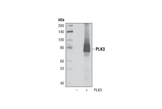  Image 3: Polo-like Kinase Antibody Sampler Kit