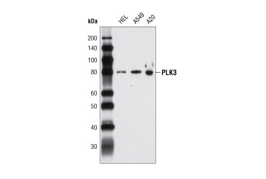  Image 7: Polo-like Kinase Antibody Sampler Kit