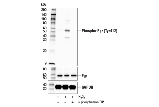 Western Blotting Image 1: Phospho-Fgr (Tyr412) Antibody
