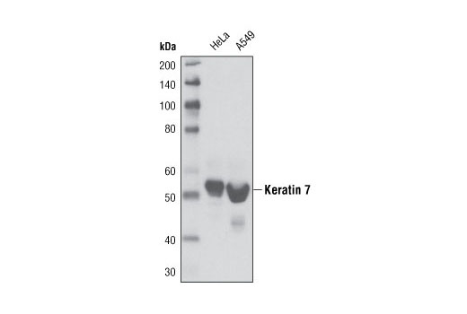 Western Blotting Image 1: Keratin 7 (R458) Antibody