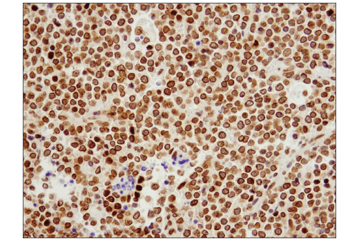 Immunohistochemistry Image 2: Exportin-1/CRM1 (D6V7N) Rabbit mAb (BSA and Azide Free)