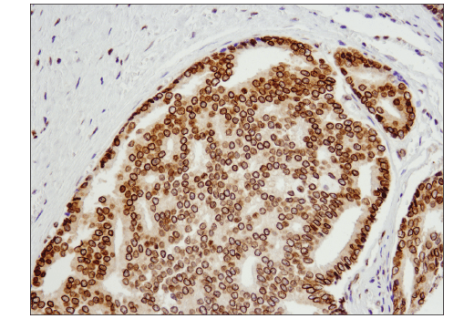 Immunohistochemistry Image 4: Exportin-1/CRM1 (D6V7N) Rabbit mAb (BSA and Azide Free)