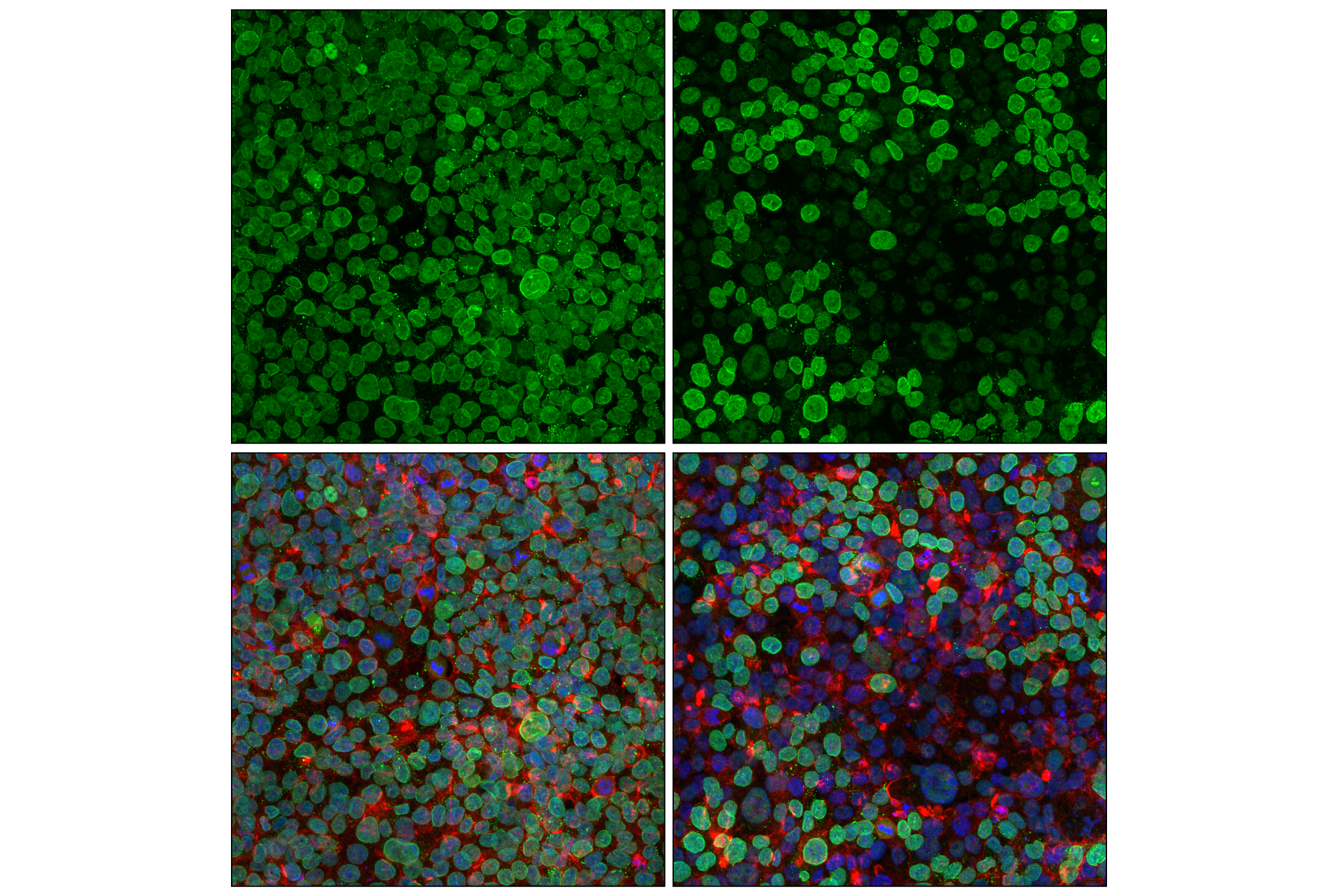 Immunofluorescence Image 1: Exportin-1/CRM1 (D6V7N) Rabbit mAb (BSA and Azide Free)