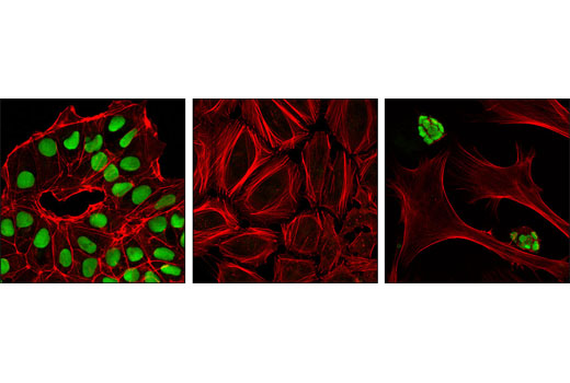 Immunofluorescence Image 1: Sox2 (L1D6A2) Mouse mAb
