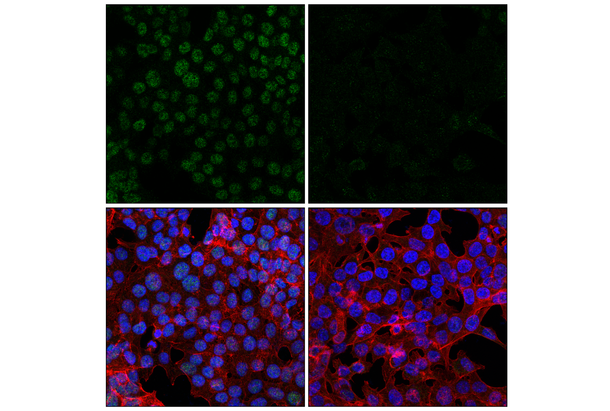 Immunofluorescence Image 1: ALKBH5 (E3F6E) Rabbit mAb