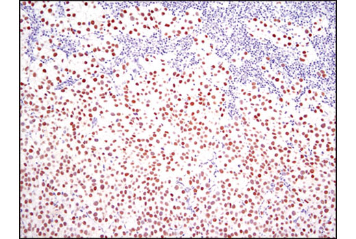Immunohistochemistry Image 1: Nanog (D73G4) XP® Rabbit mAb