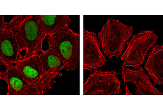 Immunofluorescence Image 1: Nanog (D73G4) XP® Rabbit mAb