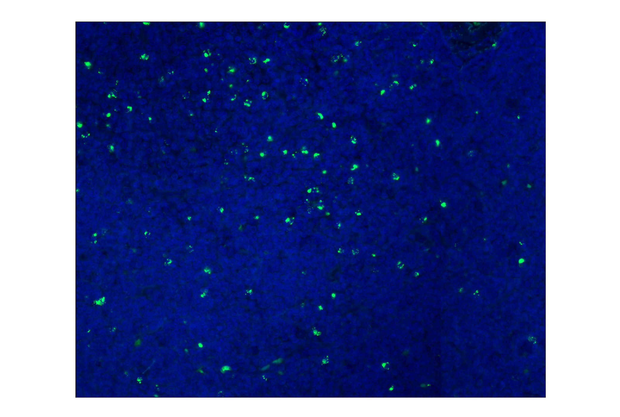 Immunohistochemistry Image 1: Granzyme B (D6E9W) Rabbit mAb (Alexa Fluor® 488 Conjugate)