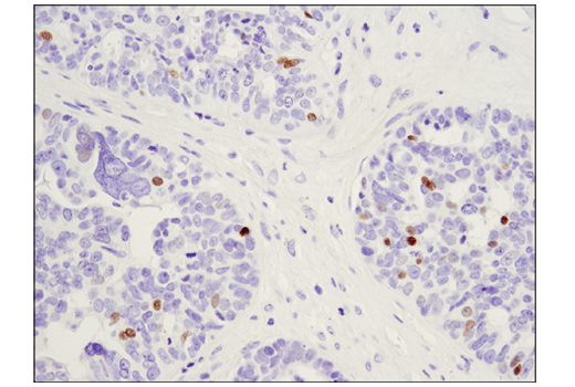 Immunohistochemistry Image 2: c-Myb (D1B9E) Rabbit mAb (BSA and Azide Free)