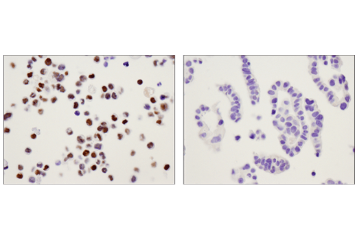 Immunohistochemistry Image 3: c-Myb (D1B9E) Rabbit mAb (BSA and Azide Free)