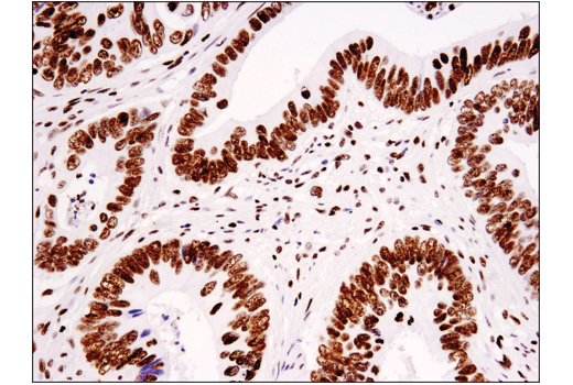 Immunohistochemistry Image 2: Tri-Methyl-Histone H3 (Lys36) (D5A7) XP® Rabbit mAb