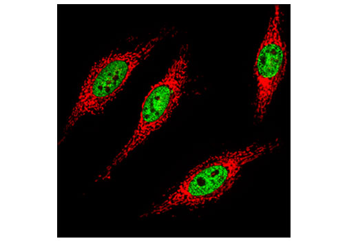 Immunofluorescence Image 1: Tri-Methyl-Histone H3 (Lys36) (D5A7) XP® Rabbit mAb