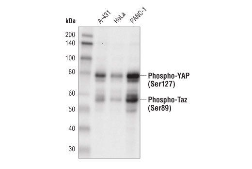 Western Blotting Image 2: Phospho-YAP (Ser127) Antibody