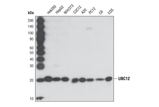 Western Blotting Image 1: Ubc12 Antibody