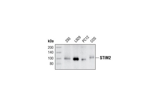 Western Blotting Image 1: STIM2 Antibody