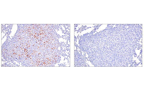 Immunohistochemistry Image 4: PD-L2 (D6L5A) Rabbit mAb